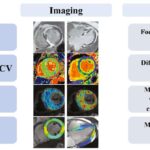 Cardiac Magnetic Resonance Visualization of the Myocardial Microstructure