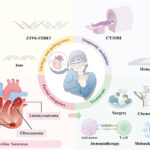 Deciphering Cardiac Sarcomas