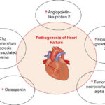 Adipokines Pathogenesis in Heart Failure