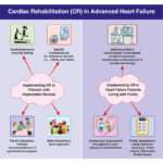 Cardiac Rehabilitation in Patients with Advanced Heart Failure