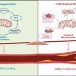 Mitochondrial Quality Control (MQC)