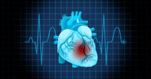 Palliative care, Heart failure